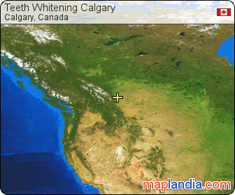 Teeth Whitening Calgary satellite map